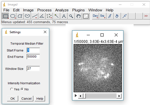Fast Temporal Median Filter for ImageJ